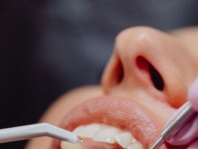 A Day of FREE Dental Care.